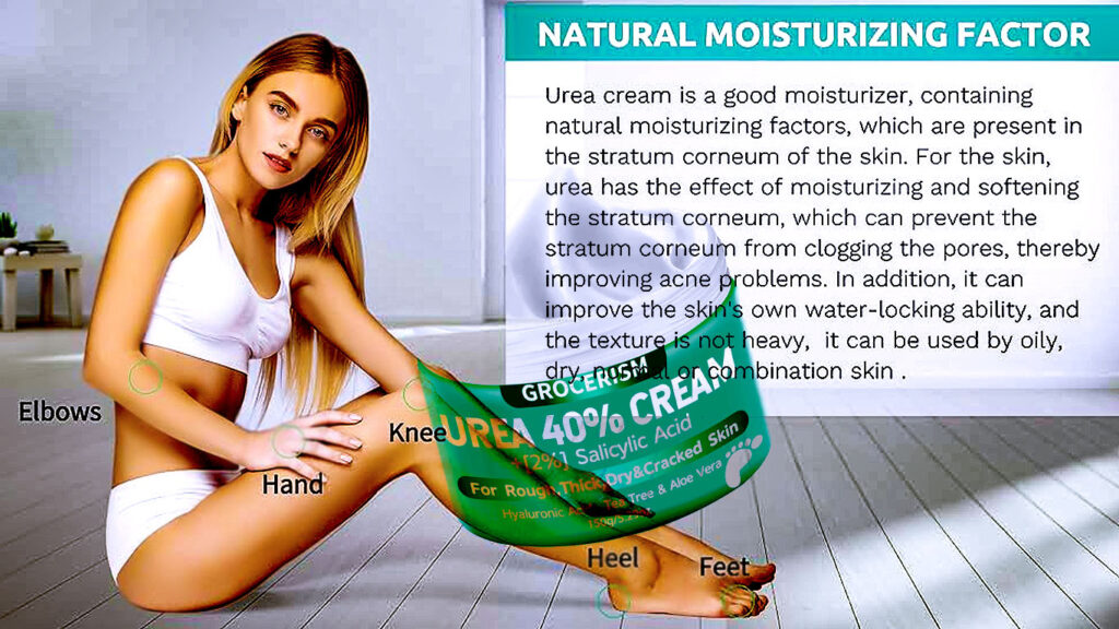 Urea Cream 40 Percent