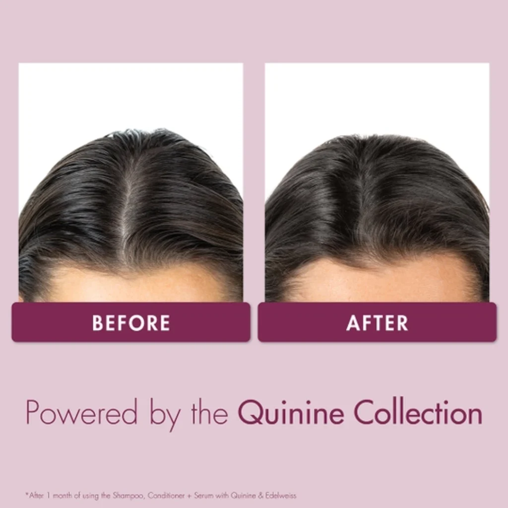 Strengthening Serum with Quinine and Edelweiss