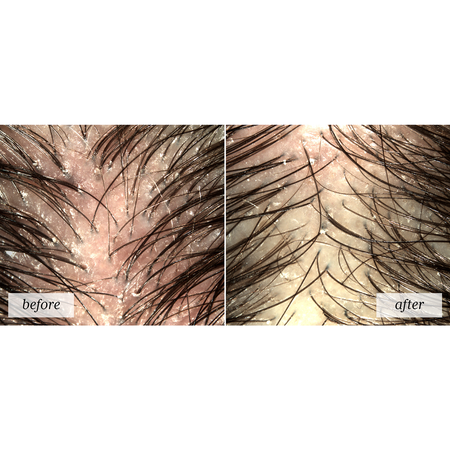 rf_headspa_asterafresh_before-after Head Spa ASTERA Soothing Concentrate