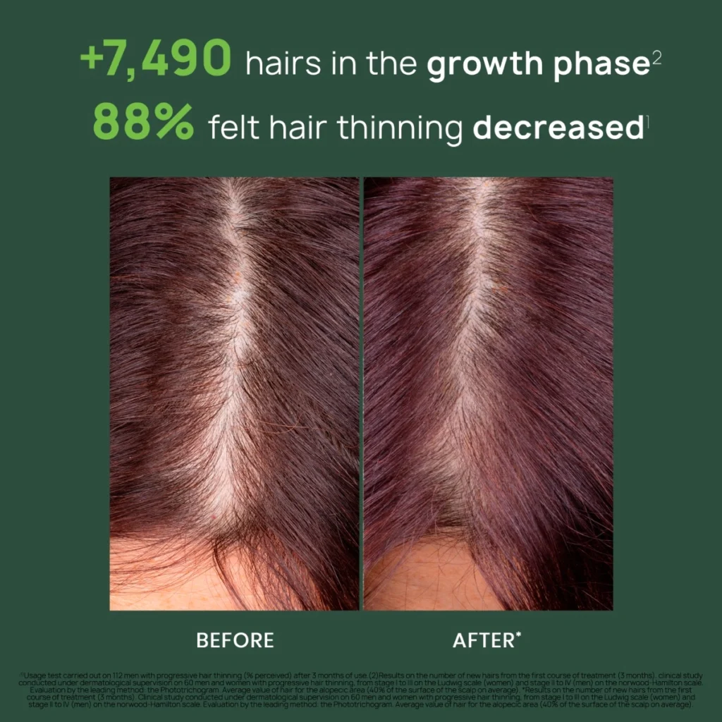 Triphasic Progressive Concentrated Serum