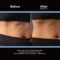 This is ideal for use on any part of the body