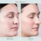 Visibly helps brighten and hydrate the undereye area
