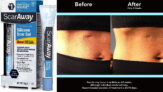 This is ideal for use on any part of the body