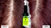 Triphasic Progressive Concentrated Serum