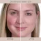 Clinically proven to correct and prevent your biggest skin concerns